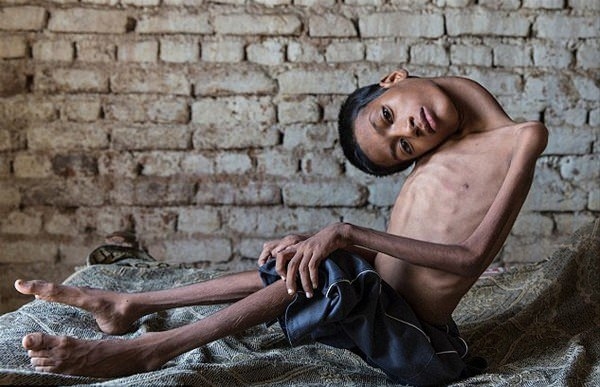 Foto - 12 yıl bu halde yaşadı!