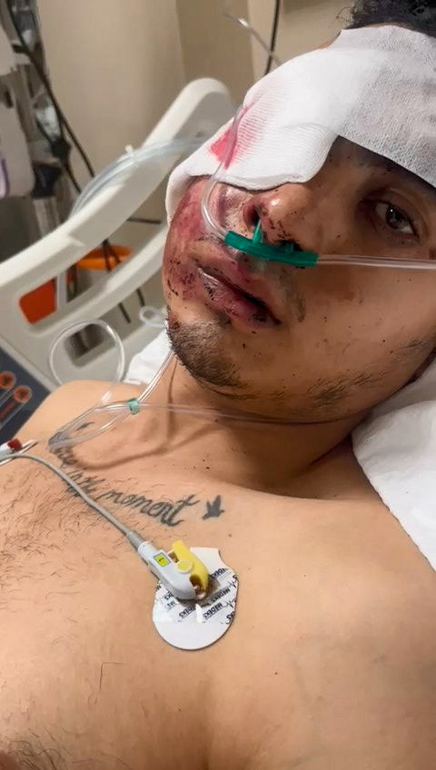 Foto - 130 kilometre hızla motosiklete çarpan alkollü sürücüye verilen ceza tepki çekti