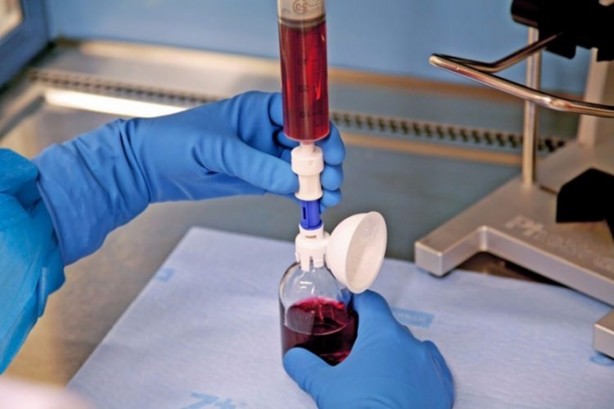 Foto - 15 dakikada kanserden kurtulmak mümkün!