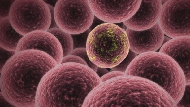 Foto - 15 dakikada kanserden kurtulmak mümkün!