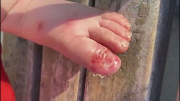 Foto - 1,5 yaşındaki bebeğe işkence! Vicdansız babaya meydan dayağı