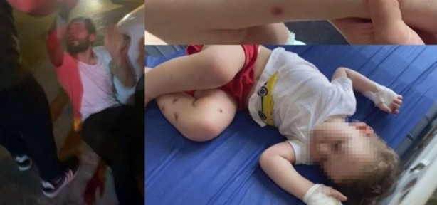 1,5 yaşındaki bebeğe işkence! Vicdansız babaya meydan dayağı