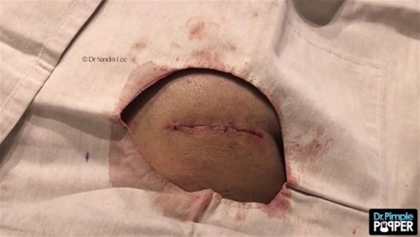 Foto - 17 yıl boyunca beyninde solucanla yaşadı