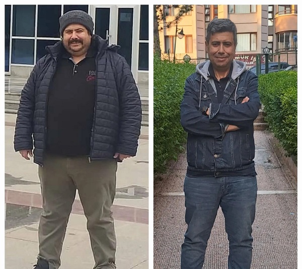 Foto - 18 ayda tam 80 kilo verdi! 
