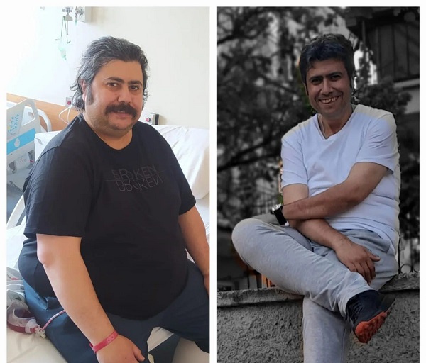 18 ayda tam 80 kilo verdi! 