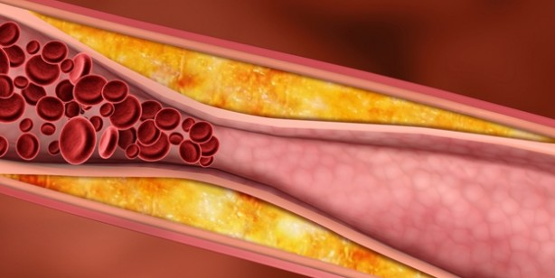 Foto - 18'lik hafıza için 3 besin! Şaşırtan olay: Bundan böyle unutacağınız tek şey 'unutkanlık' olacak!