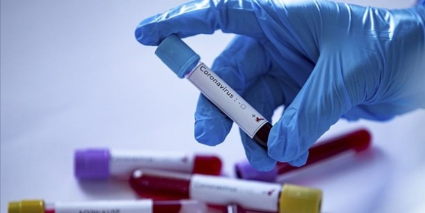 19 Nisan 2020 itibariyle grafiklerle Türkiye'nin son koronavirüs tablosu