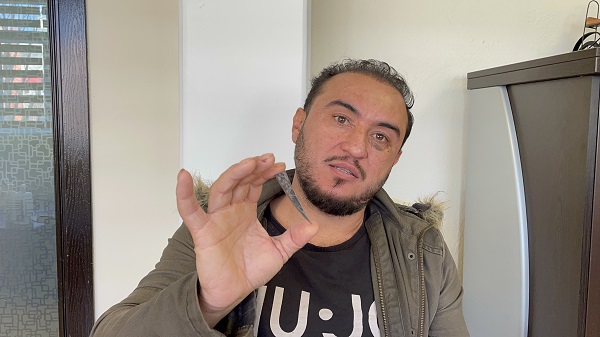 Foto - 2 aydır haberi bile yoktu! Röntgen çekilince hayatının şokunu yaşadı