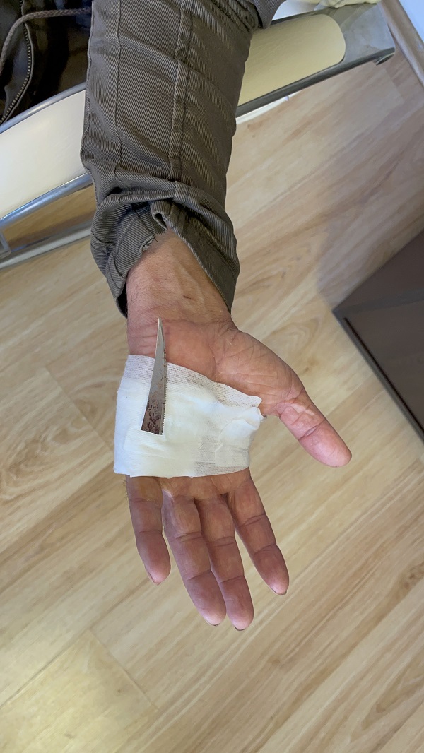 Foto - 2 aydır haberi bile yoktu! Röntgen çekilince hayatının şokunu yaşadı