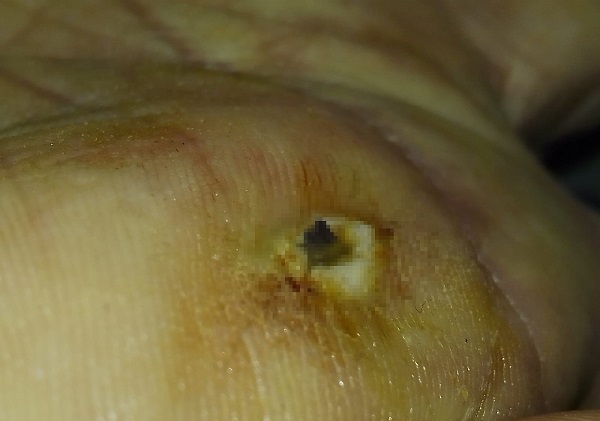 Foto - 2 aydır haberi bile yoktu! Röntgen çekilince hayatının şokunu yaşadı