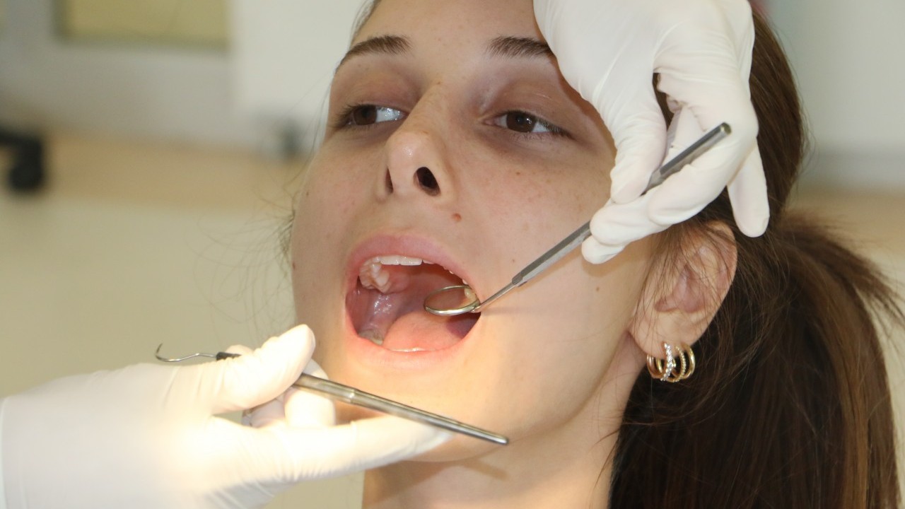 2 haftadan uzun sürerse diş hekimine gidin: Bu rahatsızlığı yaşayanların yüzde 25'i ölüyor!