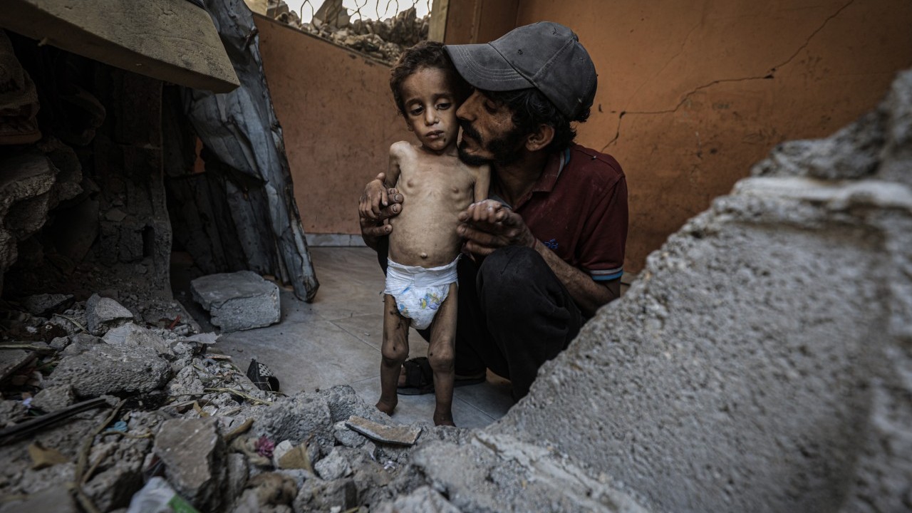 Foto - 2 yaşında... Ölümle karşı karşıya!..