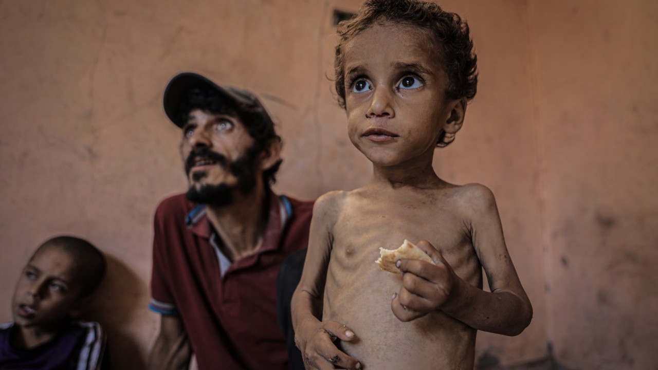 Foto - 2 yaşında... Ölümle karşı karşıya!..