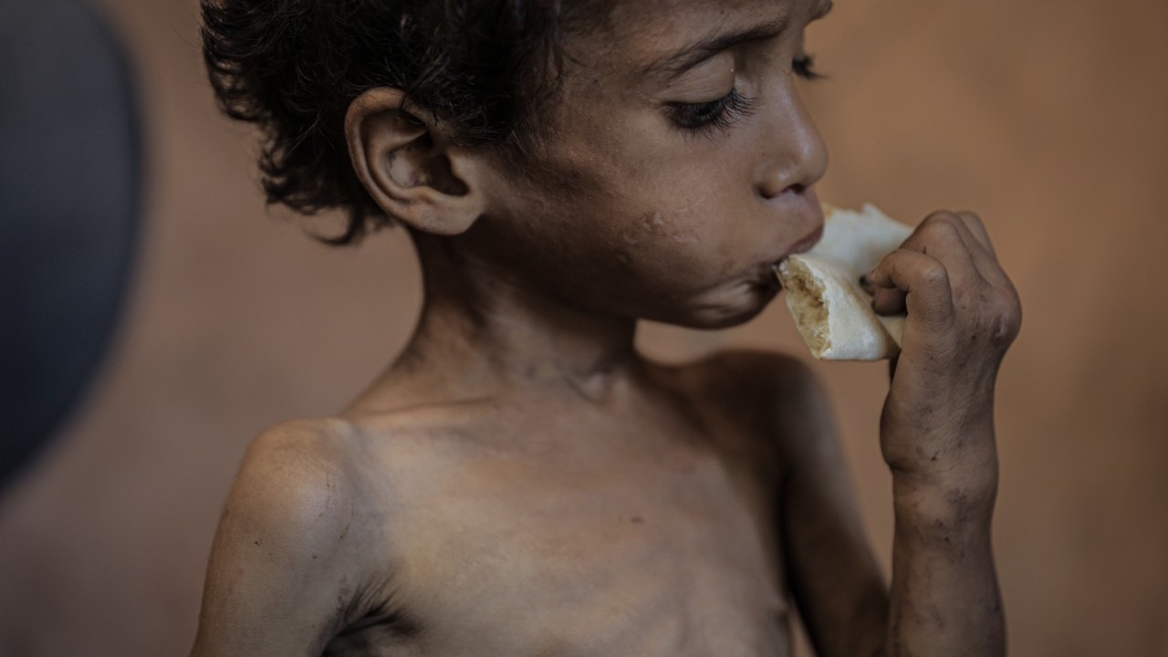 Foto - 2 yaşında... Ölümle karşı karşıya!..