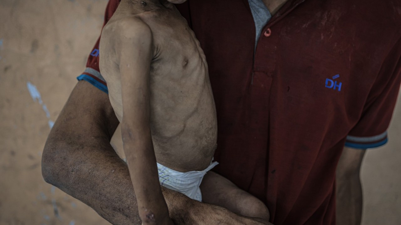 Foto - 2 yaşında... Ölümle karşı karşıya!..