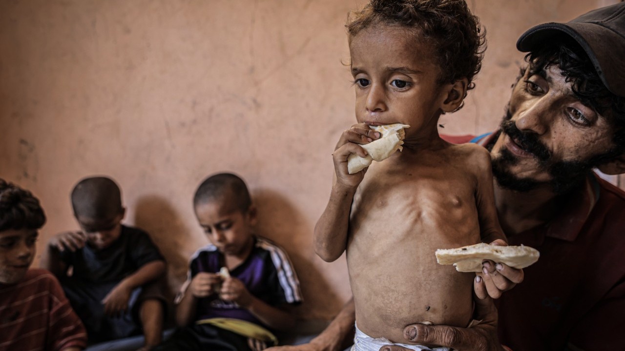 Foto - 2 yaşında... Ölümle karşı karşıya!..