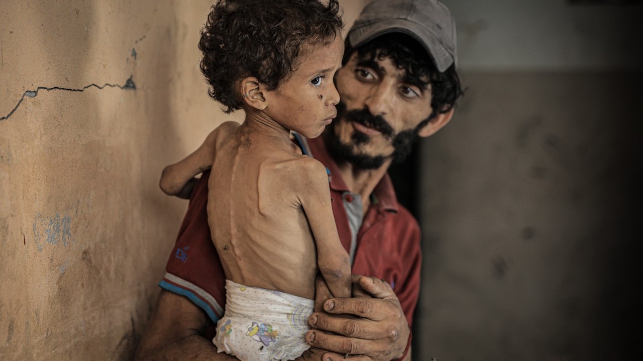 Foto - 2 yaşında... Ölümle karşı karşıya!..