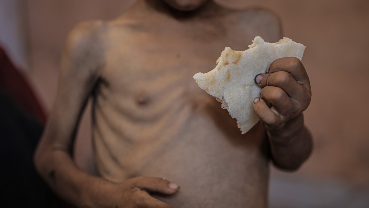 Foto - 2 yaşında... Ölümle karşı karşıya!..