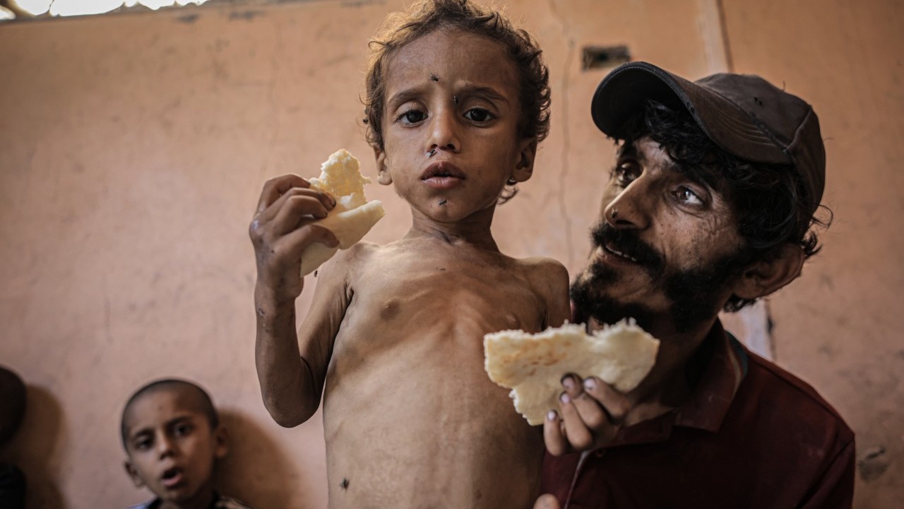 Foto - 2 yaşında... Ölümle karşı karşıya!..