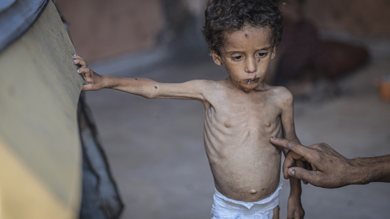 2 yaşında... Ölümle karşı karşıya!..