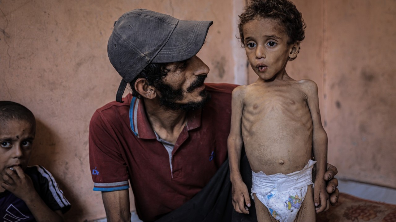 Foto - 2 yaşında... Ölümle karşı karşıya!..