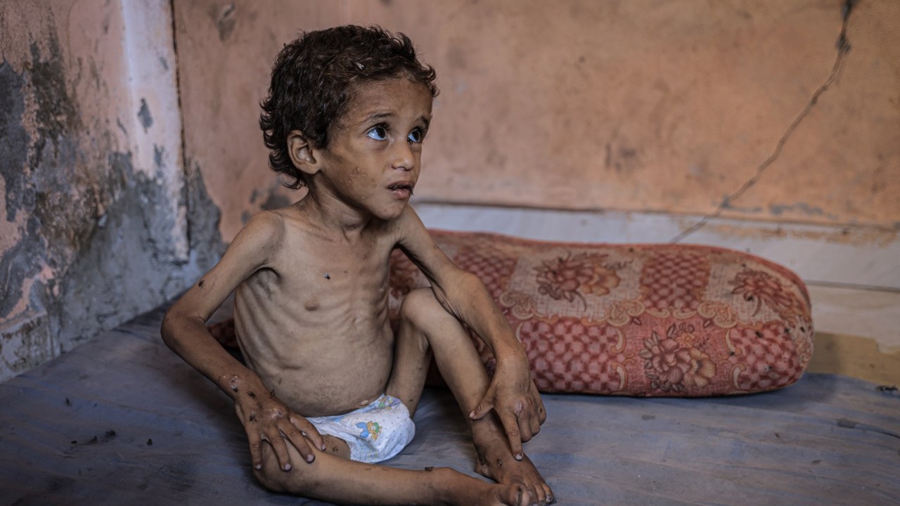 Foto - 2 yaşında... Ölümle karşı karşıya!..