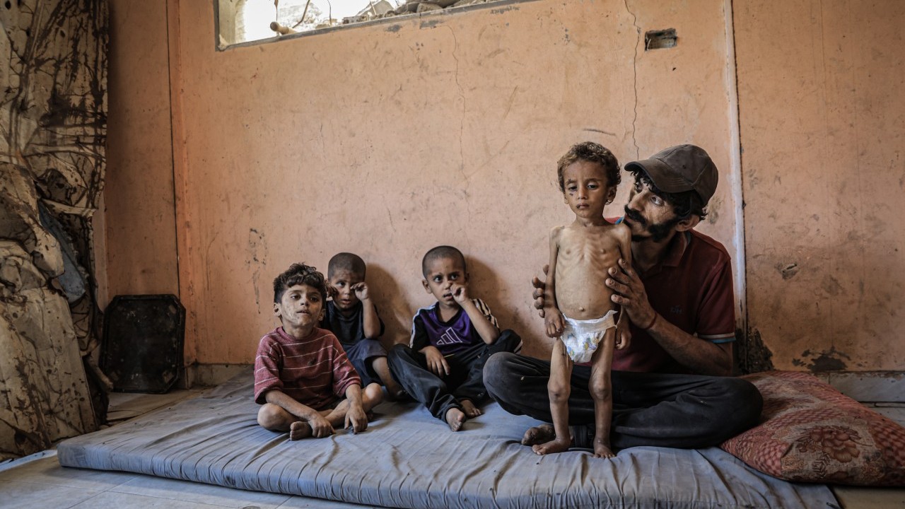 Foto - 2 yaşında... Ölümle karşı karşıya!..