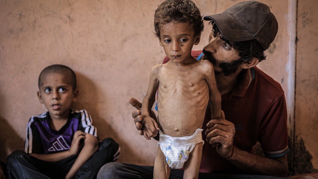 Foto - 2 yaşında... Ölümle karşı karşıya!..