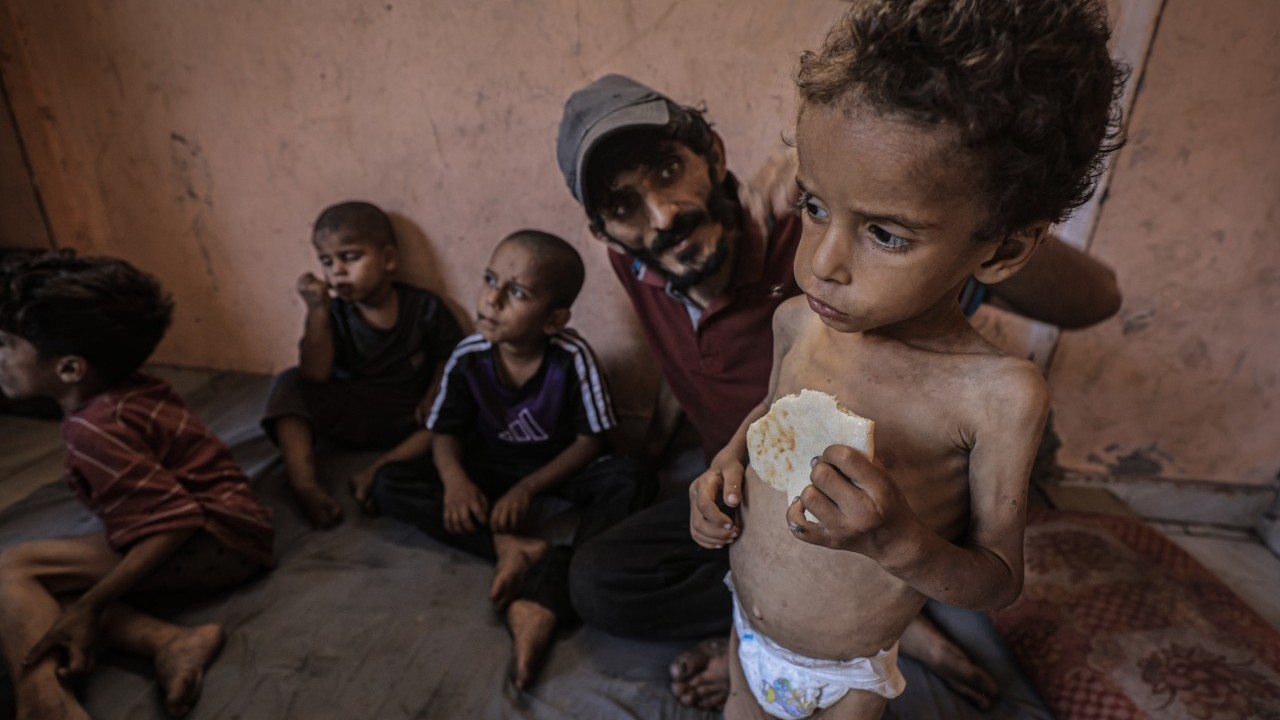 Foto - 2 yaşında... Ölümle karşı karşıya!..