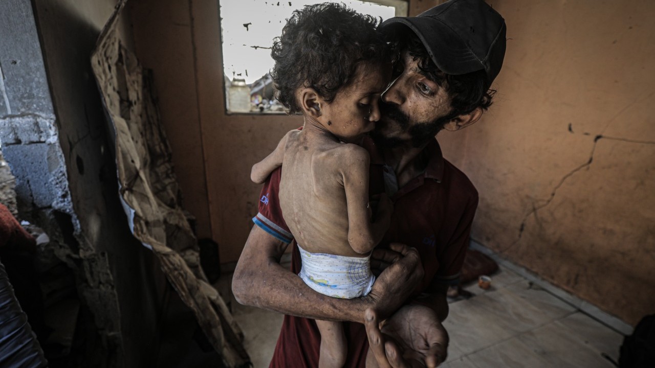 Foto - 2 yaşında... Ölümle karşı karşıya!..