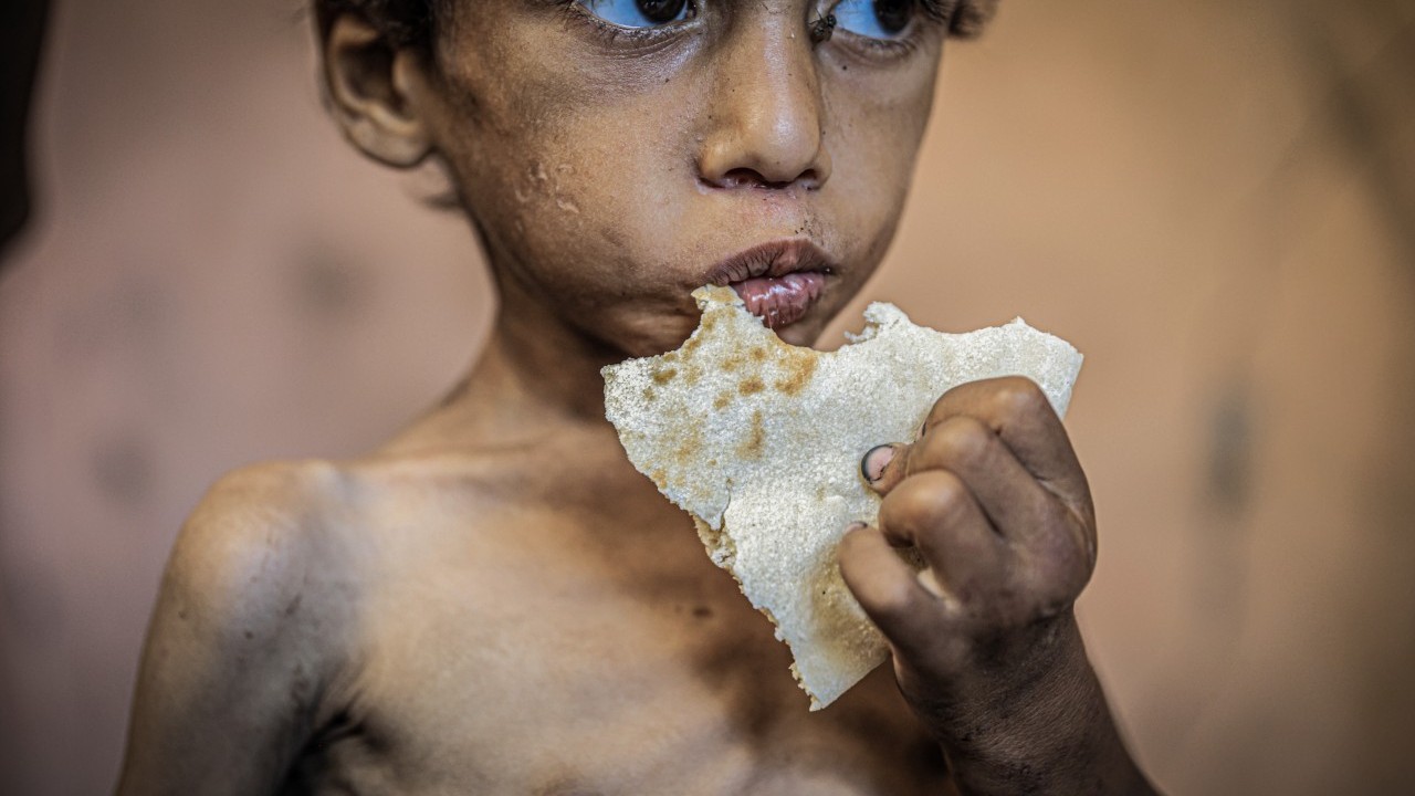 Foto - 2 yaşında... Ölümle karşı karşıya!..