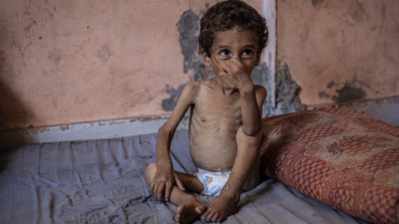 Foto - 2 yaşında... Ölümle karşı karşıya!..