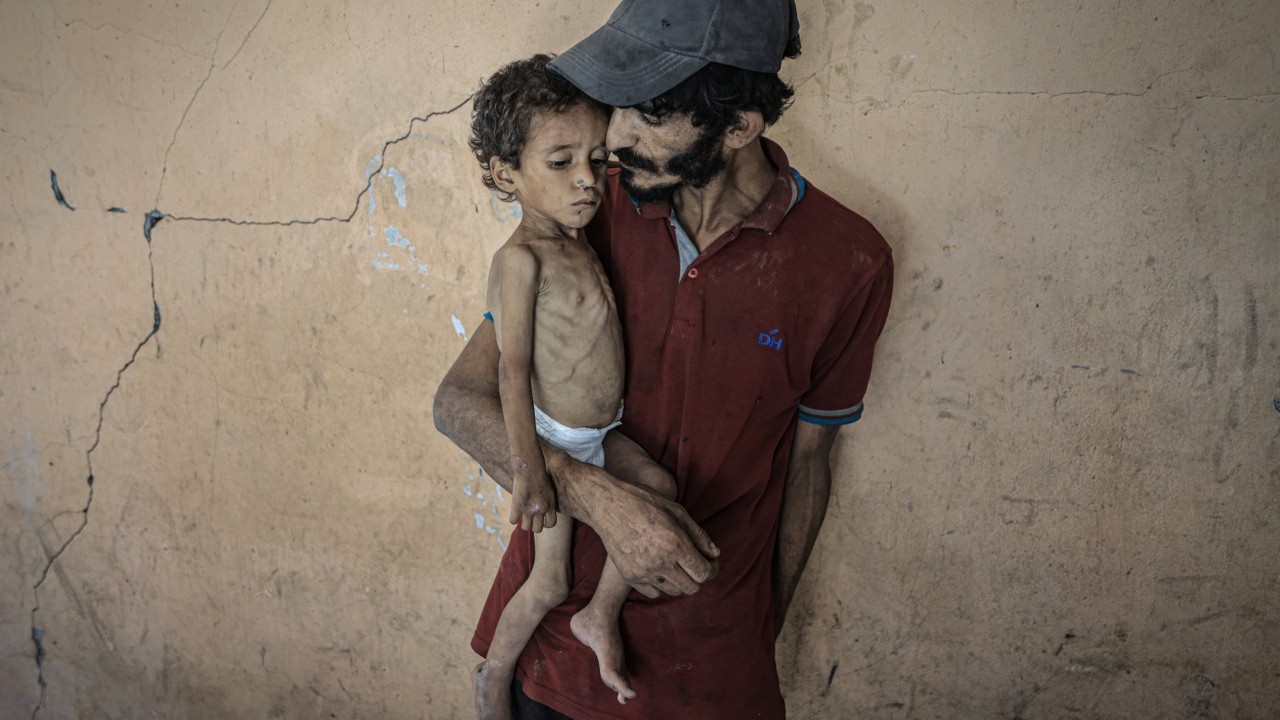 Foto - 2 yaşında... Ölümle karşı karşıya!..