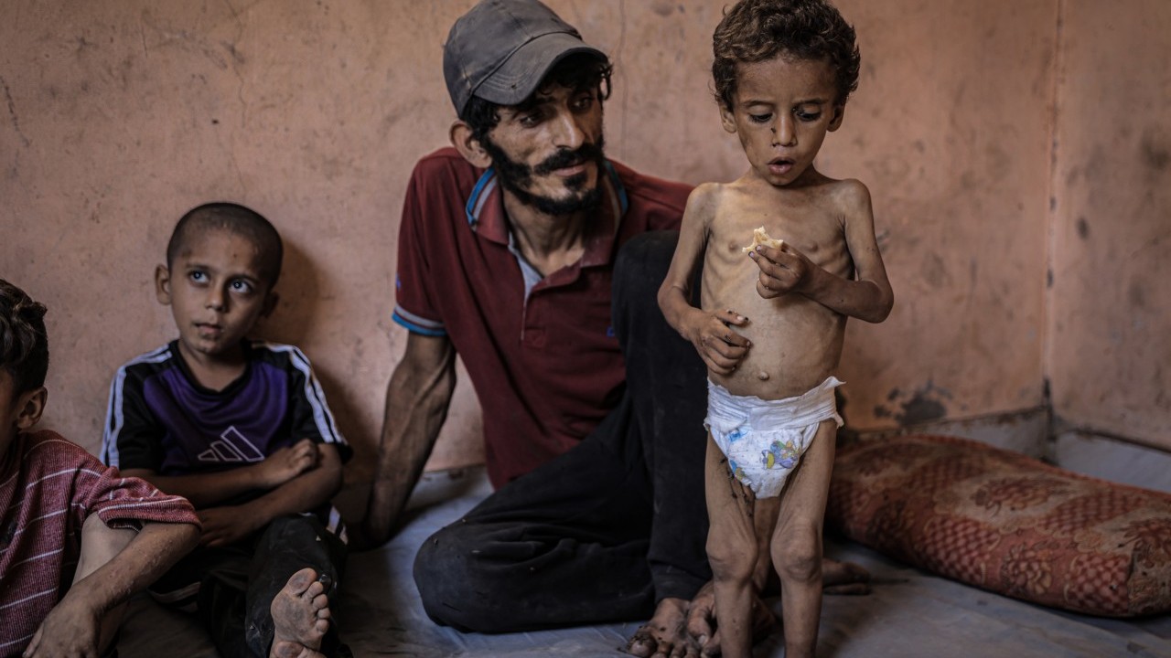 Foto - 2 yaşında... Ölümle karşı karşıya!..