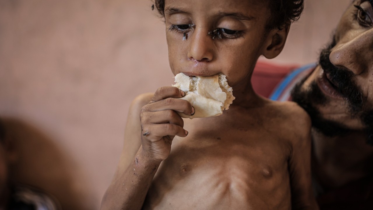 Foto - 2 yaşında... Ölümle karşı karşıya!..