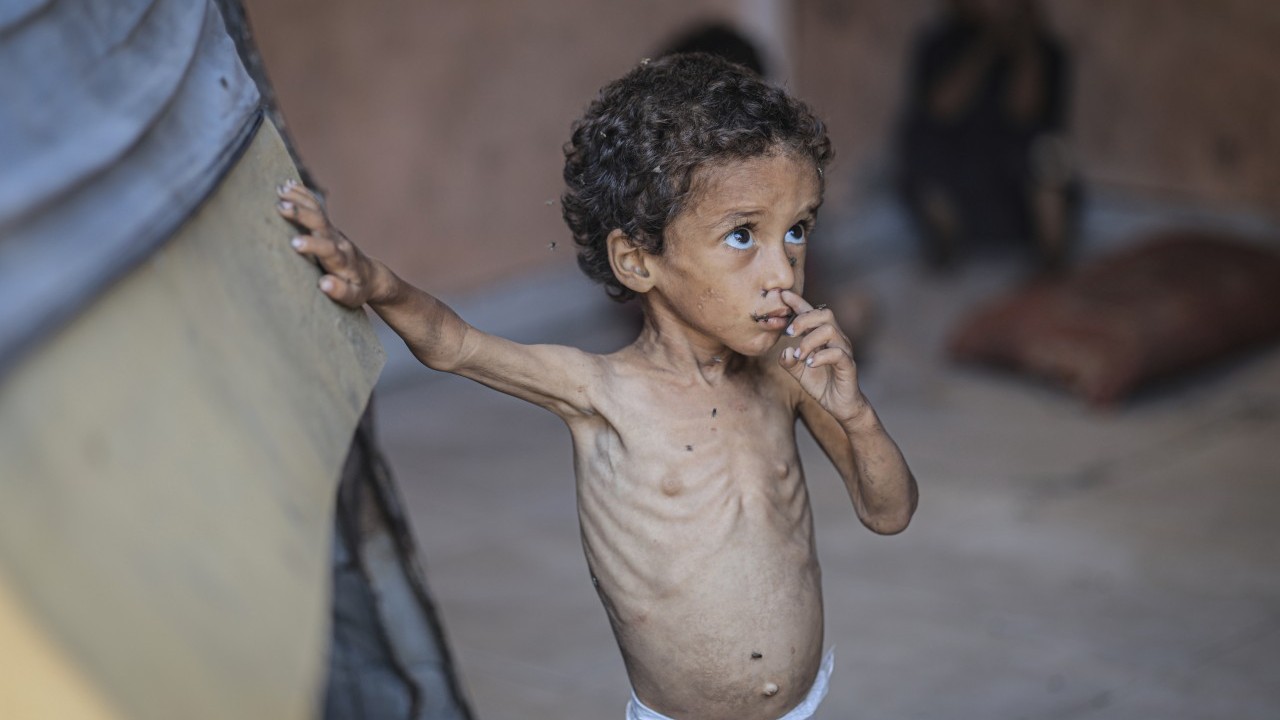 Foto - 2 yaşında... Ölümle karşı karşıya!..