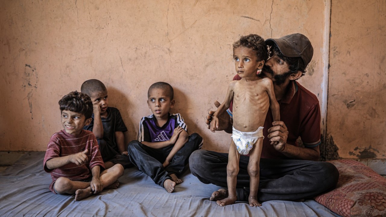 Foto - 2 yaşında... Ölümle karşı karşıya!..