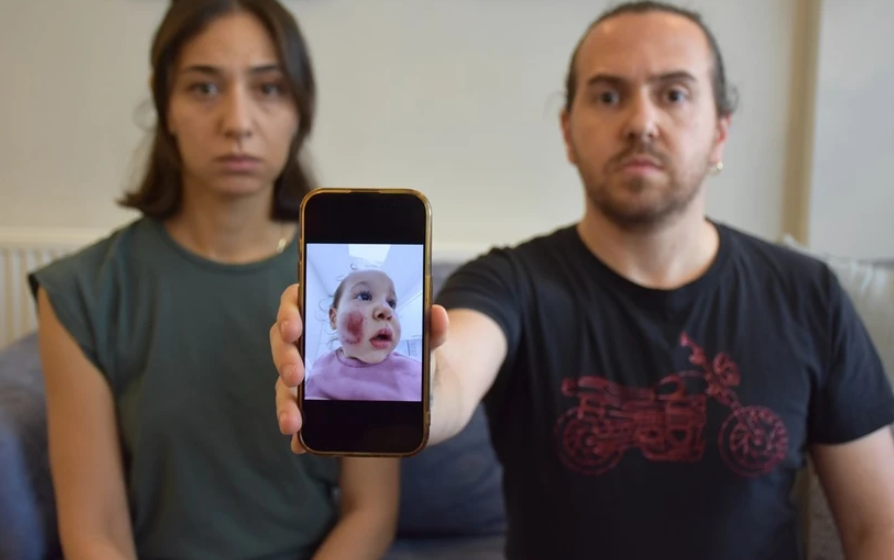 2 yaşındaki bebeğe akran zorbalığı! Çocuk kan ve morluklar içindeydi