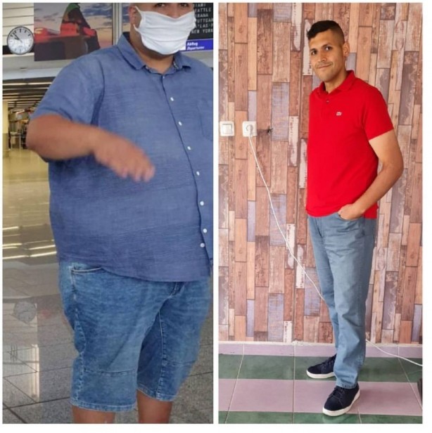 Foto - 2 yılda yarısından buhar oldu: ‘Görmezsem inanmazdım’ dedirtecek olay