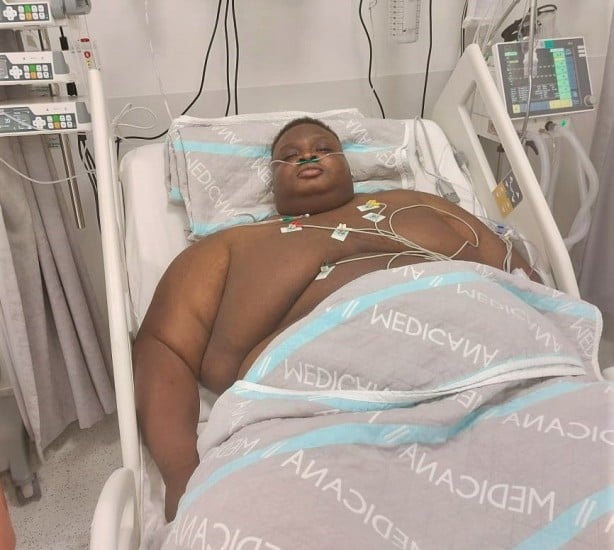 200 kilogram ağırlığındaki Nijerli, Türkiye'de ameliyat oldu