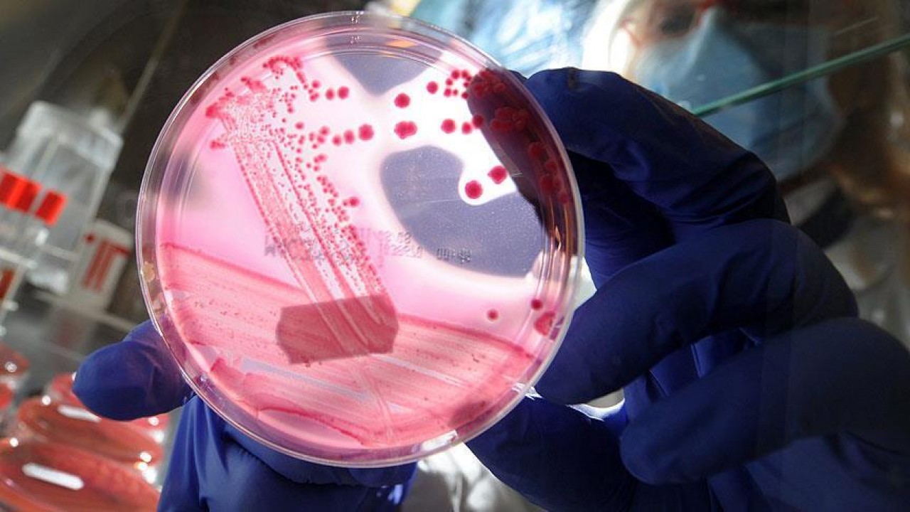 Foto - 2050 yılı için şok eden tahmin! Kanser koptu gidiyor