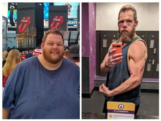 Foto - 265 kilodan 100 kiloya ameliyatsız düşen adam şok etti! Meğer zayıflamanın sırrı buymuş