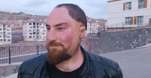 Foto - 28 yılda 26 kaza geçirdi! "Kem gözlerin kurbanı oldum"