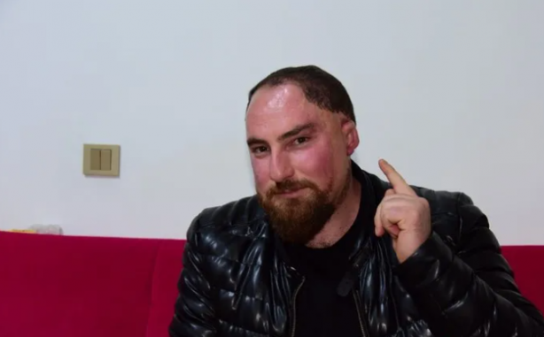 Foto - 28 yılda 26 kaza geçirdi! "Kem gözlerin kurbanı oldum"