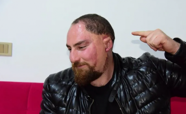 Foto - 28 yılda 26 kaza geçirdi! "Kem gözlerin kurbanı oldum"