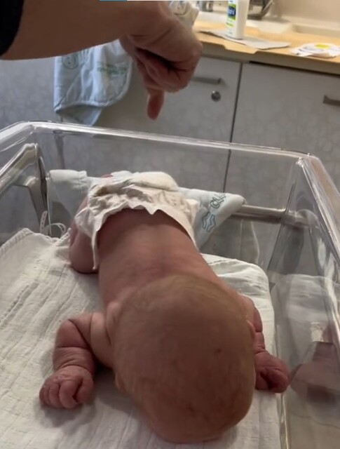 Foto - 3 günlük yenidoğan bebek dünyayı hayrete düşürdü! Öyle şeyler yapıyor ki, kimse anlam veremiyor