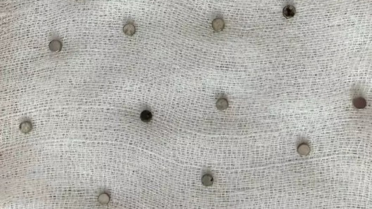 Foto - 3 yaşındaki çocuk doktorları şaşırttı! Hepsini nasıl yuttun evlat!