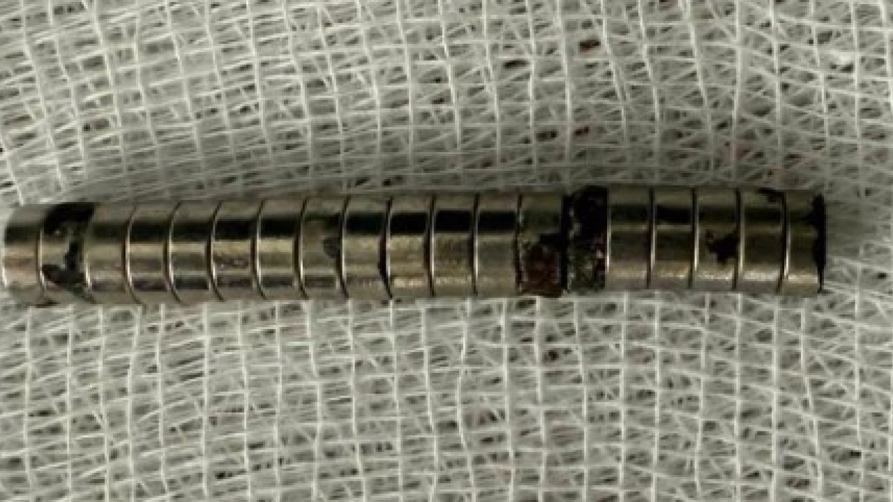 Foto - 3 yaşındaki çocuk doktorları şaşırttı! Hepsini nasıl yuttun evlat!