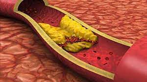 Foto - 30 günde 1 kez 4 gün arka arkaya uygulayın kötü kolesterolden kurtulun: İnsana yararlı zengin içeriğe sahip 