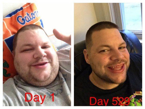 Foto - 300 kiloluk adamın son hali şaşırtıyor...